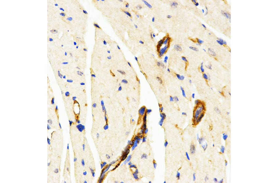 Immunohistochemistry - Anti-CD208 Antibody (A14241) - Antibodies.com