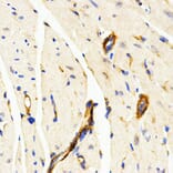 Immunohistochemistry - Anti-CD208 Antibody (A14241) - Antibodies.com