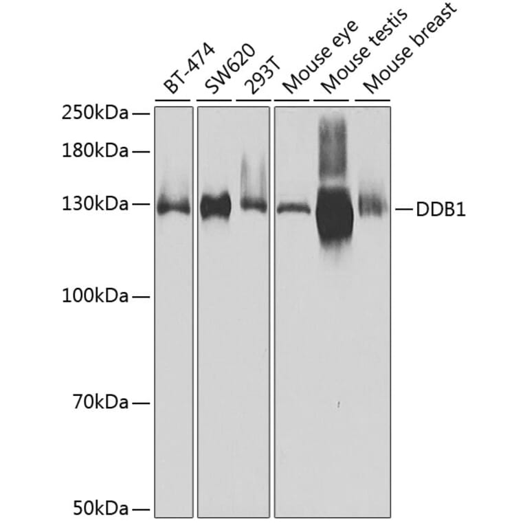 Western Blot - Anti-DDB1 Antibody (A14242) - Antibodies.com