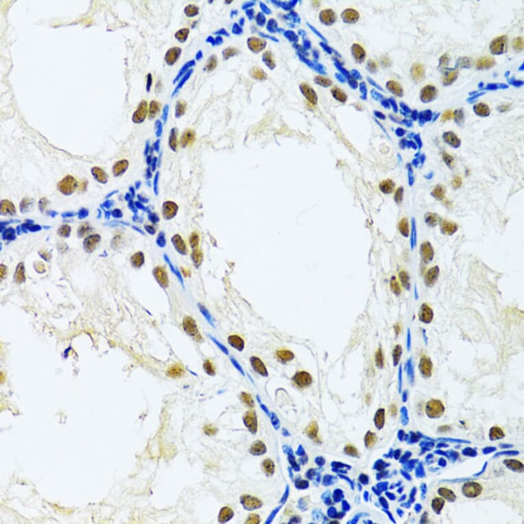 Immunohistochemistry - Anti-DDB1 Antibody (A14242) - Antibodies.com