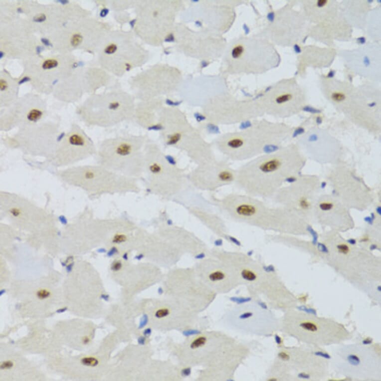 Immunohistochemistry - Anti-DDB1 Antibody (A14242) - Antibodies.com