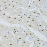 Immunohistochemistry - Anti-DDB1 Antibody (A14242) - Antibodies.com