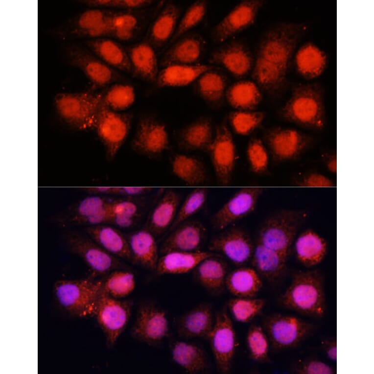 Immunofluorescence - Anti-DDB1 Antibody (A14242) - Antibodies.com