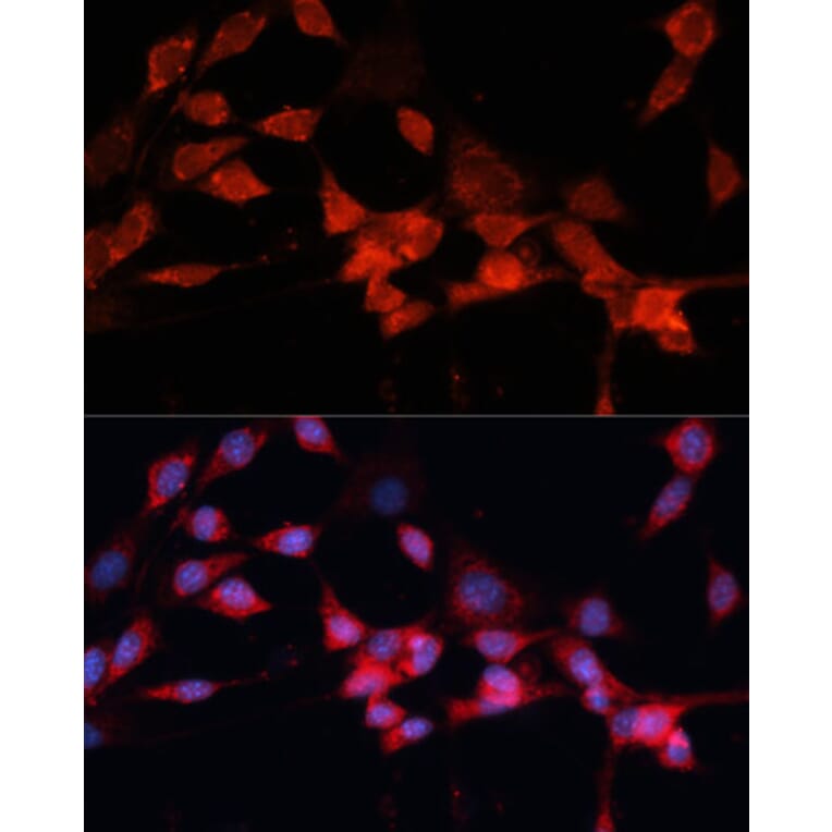 Immunofluorescence - Anti-DDB1 Antibody (A14242) - Antibodies.com