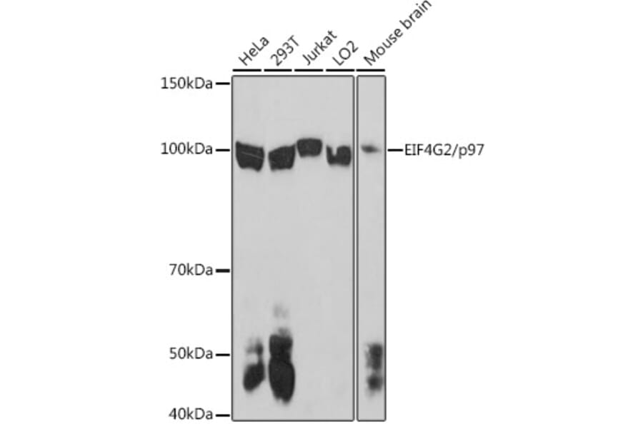 Western Blot - Anti-P97/DAP5 Antibody (A14243) - Antibodies.com