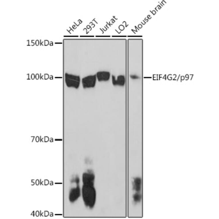 Western Blot - Anti-P97/DAP5 Antibody (A14243) - Antibodies.com
