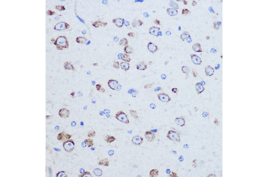 Immunohistochemistry - Anti-P97/DAP5 Antibody (A14243) - Antibodies.com