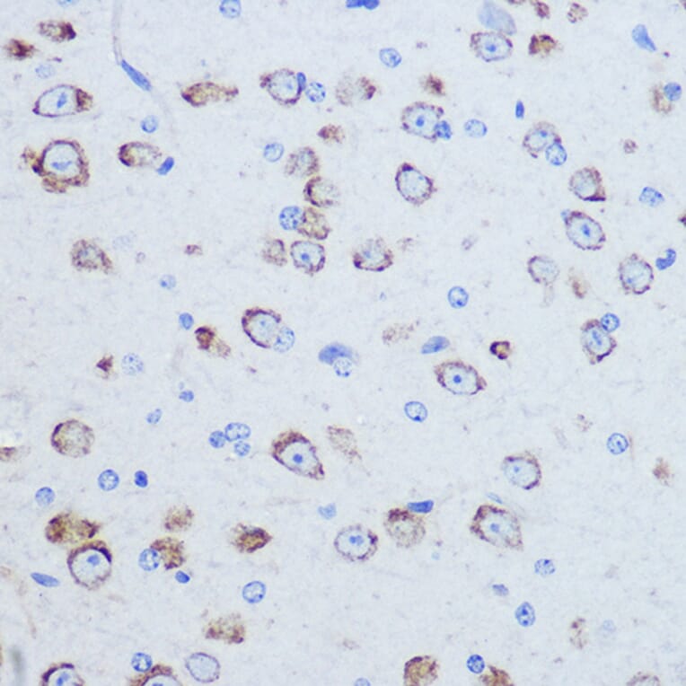 Immunohistochemistry - Anti-P97/DAP5 Antibody (A14243) - Antibodies.com