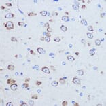 Immunohistochemistry - Anti-P97/DAP5 Antibody (A14243) - Antibodies.com