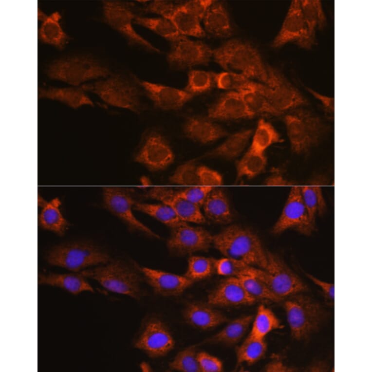 Immunofluorescence - Anti-P97/DAP5 Antibody (A14243) - Antibodies.com