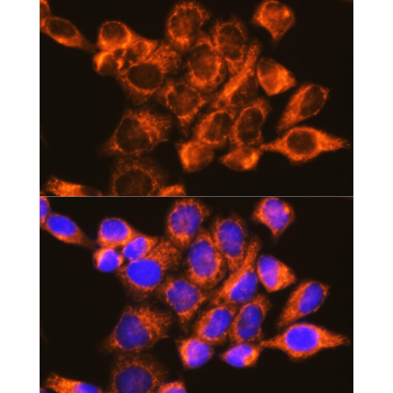 Immunofluorescence - Anti-P97/DAP5 Antibody (A14243) - Antibodies.com