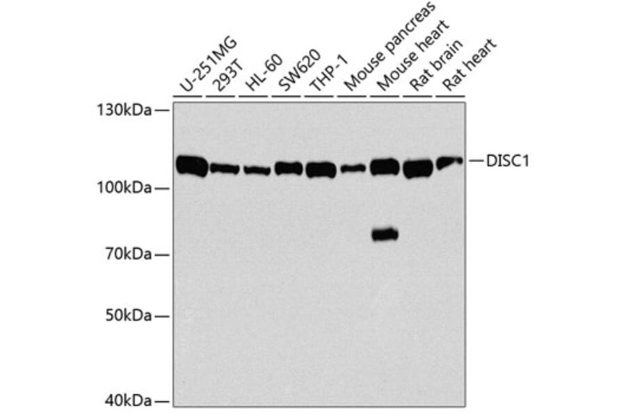 Western Blot - Anti-DISC1 Antibody (A2898) - Antibodies.com
