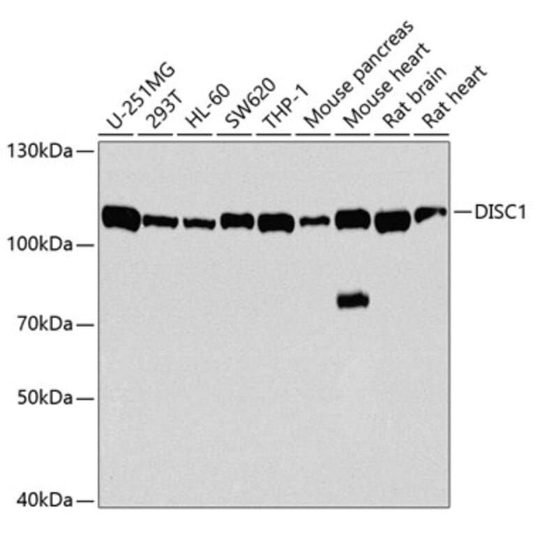 Western Blot - Anti-DISC1 Antibody (A2898) - Antibodies.com