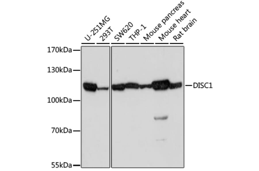 Western Blot - Anti-DISC1 Antibody (A2898) - Antibodies.com