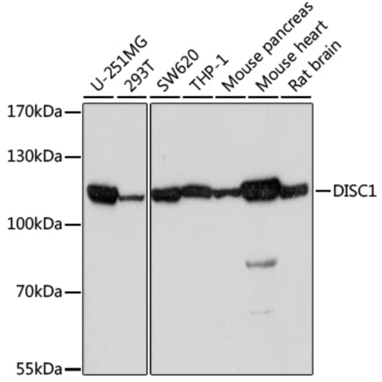 Western Blot - Anti-DISC1 Antibody (A2898) - Antibodies.com