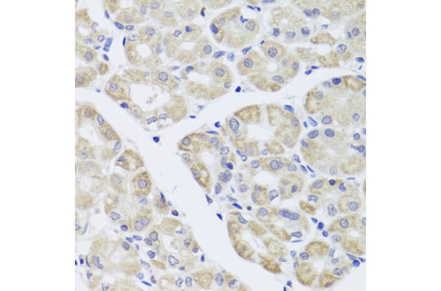Immunohistochemistry - Anti-DISC1 Antibody (A2898) - Antibodies.com
