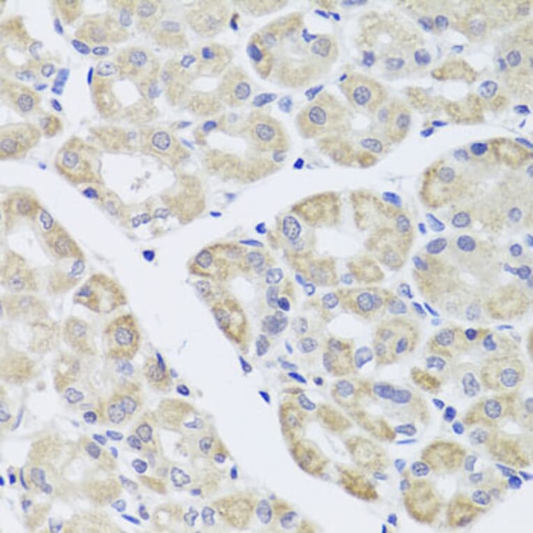 Immunohistochemistry - Anti-DISC1 Antibody (A2898) - Antibodies.com