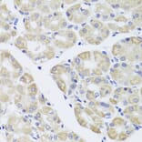Immunohistochemistry - Anti-DISC1 Antibody (A2898) - Antibodies.com