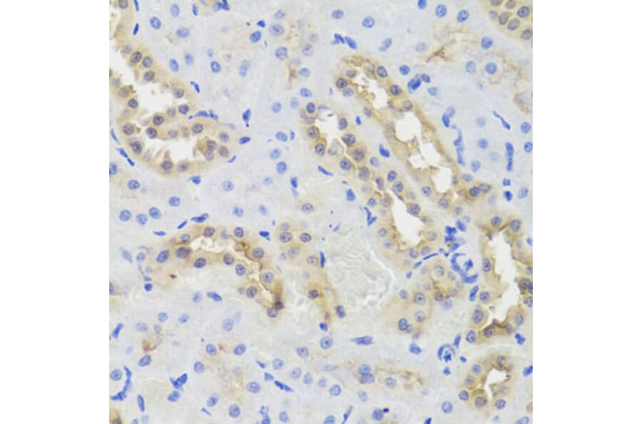 Immunohistochemistry - Anti-DISC1 Antibody (A2898) - Antibodies.com