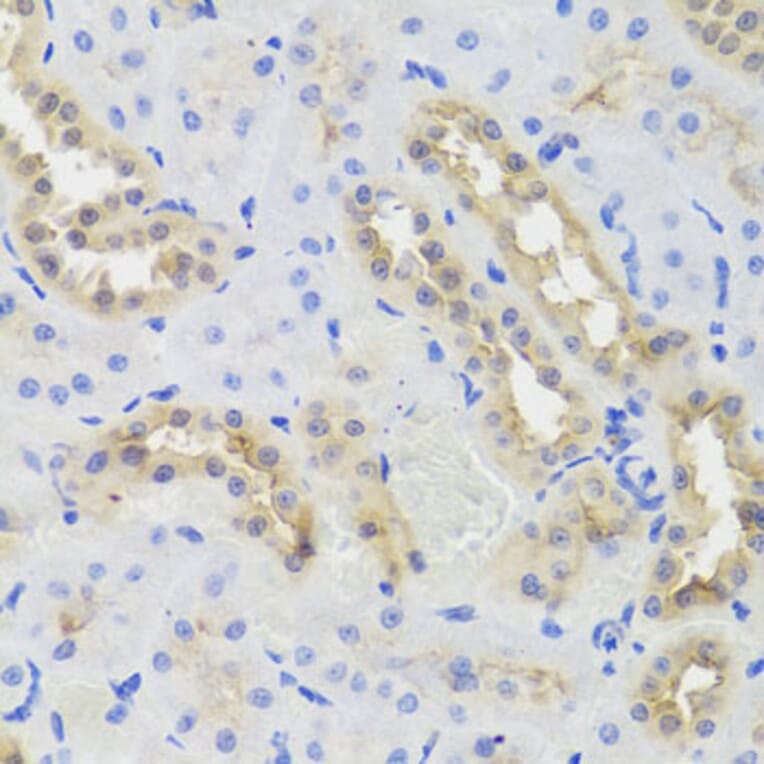 Immunohistochemistry - Anti-DISC1 Antibody (A2898) - Antibodies.com
