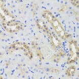 Immunohistochemistry - Anti-DISC1 Antibody (A2898) - Antibodies.com