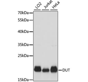 Western Blot - Anti-dUTPase Antibody (A14245) - Antibodies.com