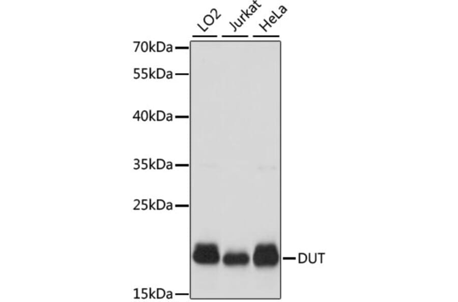 Western Blot - Anti-dUTPase Antibody (A14245) - Antibodies.com
