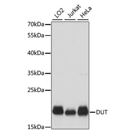 Western Blot - Anti-dUTPase Antibody (A14245) - Antibodies.com