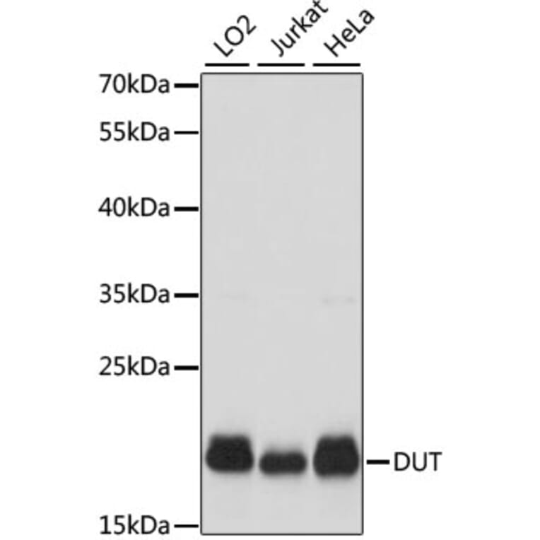Western Blot - Anti-dUTPase Antibody (A14245) - Antibodies.com