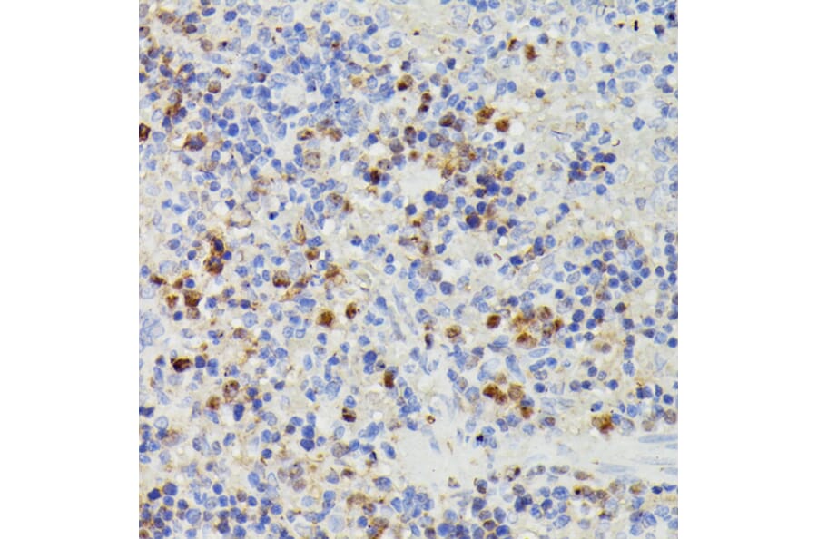 Immunohistochemistry - Anti-dUTPase Antibody (A14245) - Antibodies.com