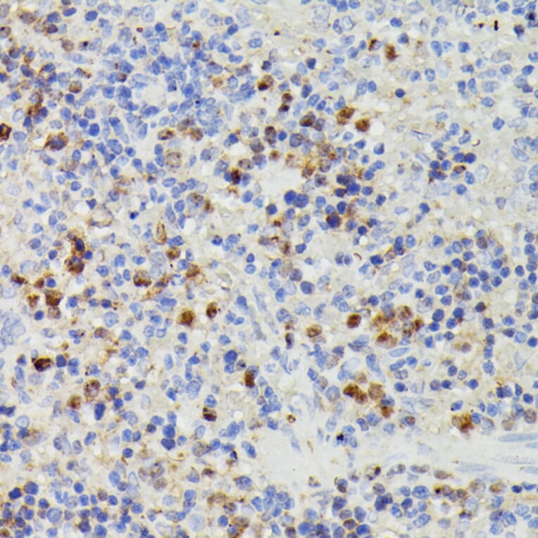 Immunohistochemistry - Anti-dUTPase Antibody (A14245) - Antibodies.com