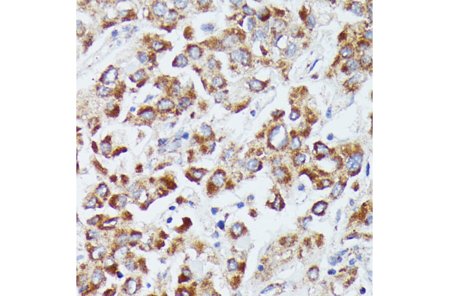Immunohistochemistry - Anti-dUTPase Antibody (A14245) - Antibodies.com