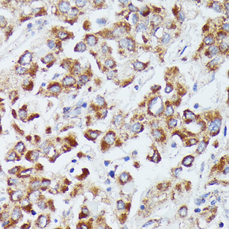 Immunohistochemistry - Anti-dUTPase Antibody (A14245) - Antibodies.com