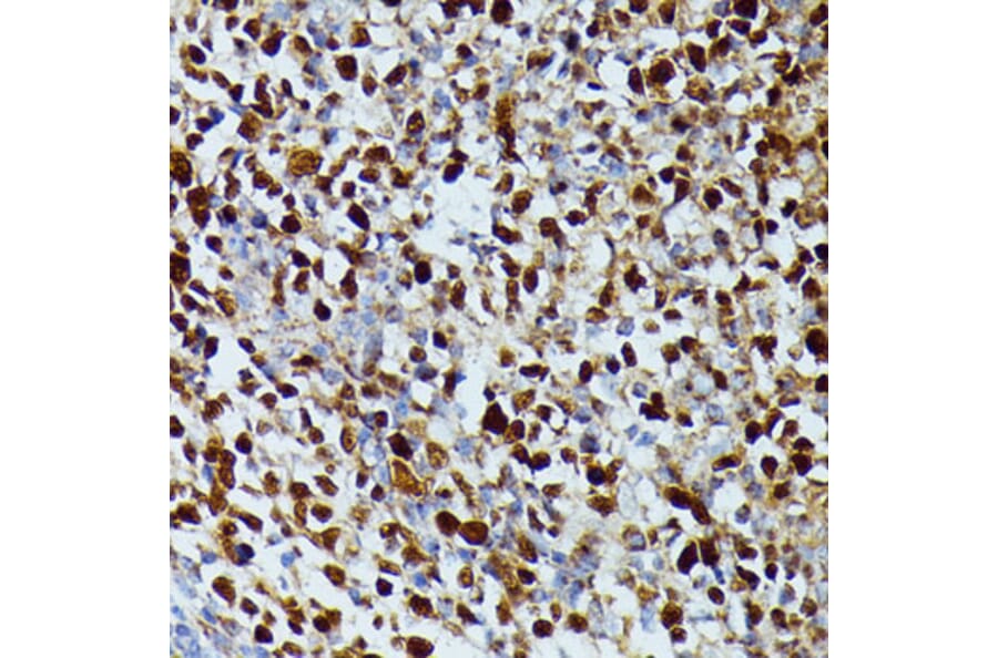 Immunohistochemistry - Anti-dUTPase Antibody (A14245) - Antibodies.com