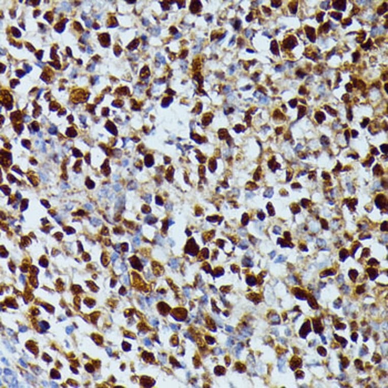 Immunohistochemistry - Anti-dUTPase Antibody (A14245) - Antibodies.com