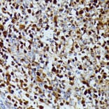 Immunohistochemistry - Anti-dUTPase Antibody (A14245) - Antibodies.com