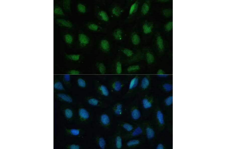 Immunofluorescence - Anti-dUTPase Antibody (A14245) - Antibodies.com