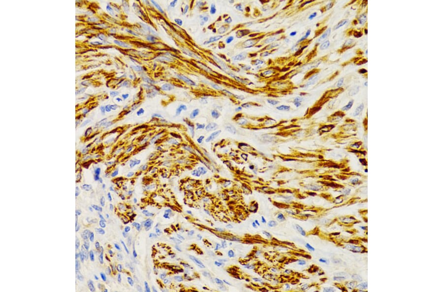 Immunohistochemistry - Anti-EDA Antibody (A14246) - Antibodies.com