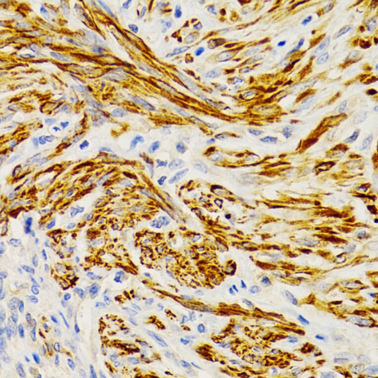 Immunohistochemistry - Anti-EDA Antibody (A14246) - Antibodies.com