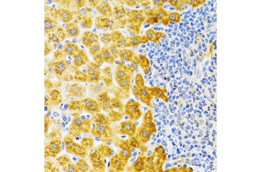 Immunohistochemistry - Anti-EDA Antibody (A14246) - Antibodies.com