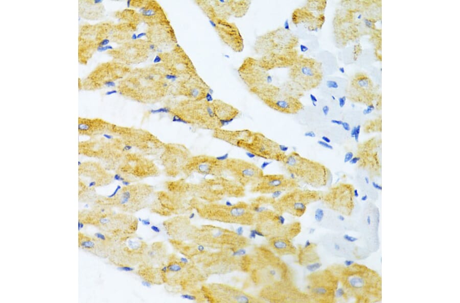 Immunohistochemistry - Anti-EDA Antibody (A14246) - Antibodies.com