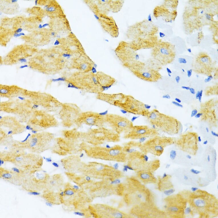 Immunohistochemistry - Anti-EDA Antibody (A14246) - Antibodies.com