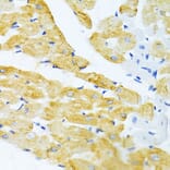 Immunohistochemistry - Anti-EDA Antibody (A14246) - Antibodies.com