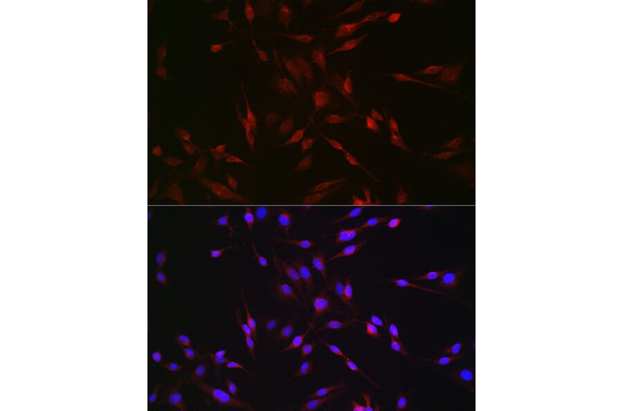 Immunofluorescence - Anti-EDA Antibody (A14246) - Antibodies.com