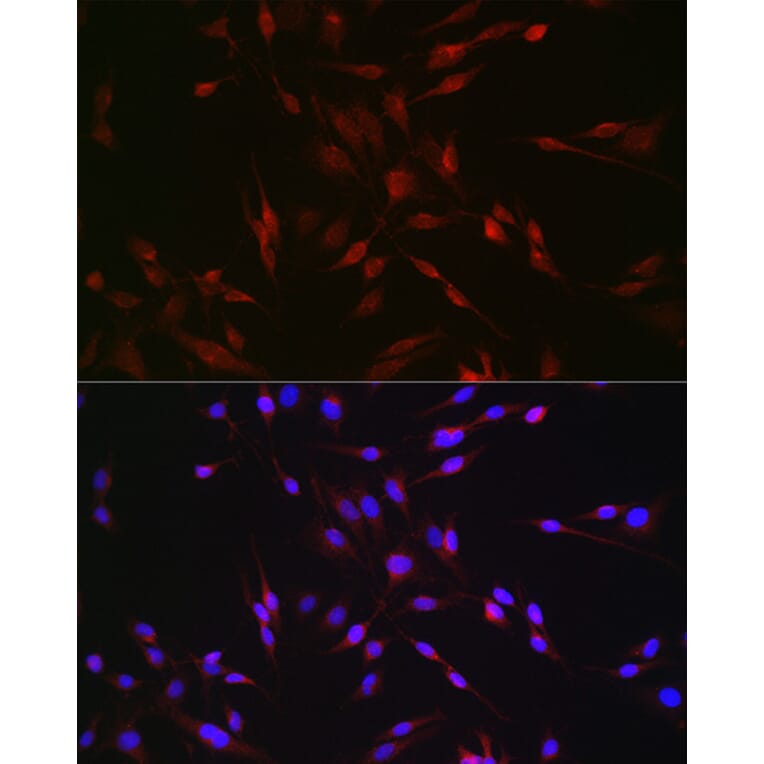 Immunofluorescence - Anti-EDA Antibody (A14246) - Antibodies.com