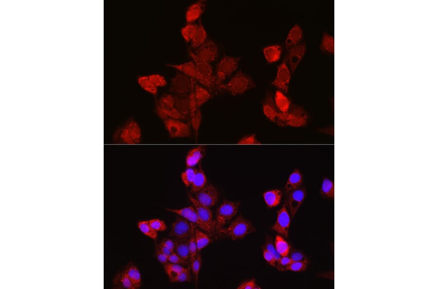 Immunofluorescence - Anti-EDA Antibody (A14246) - Antibodies.com