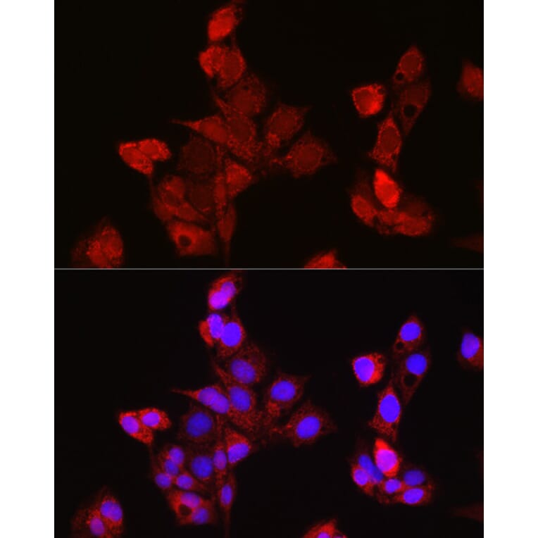 Immunofluorescence - Anti-EDA Antibody (A14246) - Antibodies.com