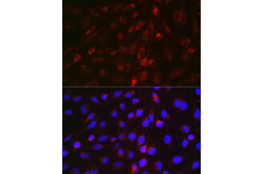 Immunofluorescence - Anti-EDA Antibody (A14246) - Antibodies.com