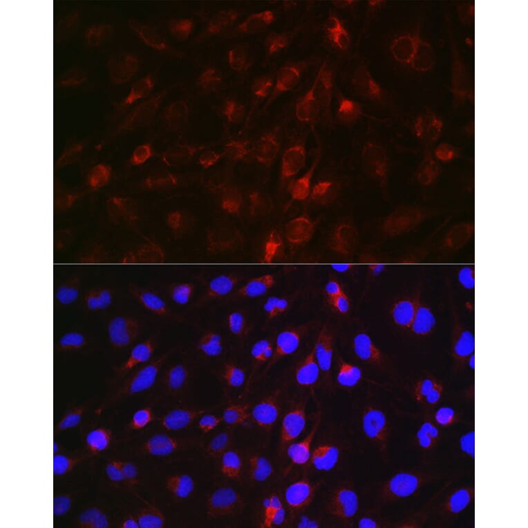 Immunofluorescence - Anti-EDA Antibody (A14246) - Antibodies.com