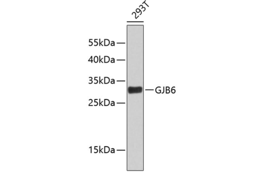 Western Blot - Anti-GJB6 Antibody (A2906) - Antibodies.com